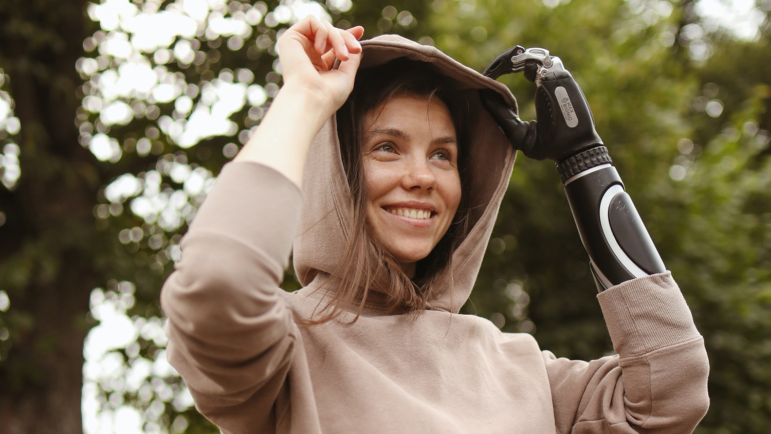 Femeie cu o proteză pe braț - asigurare de invaliditate profesională